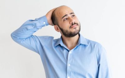 esthetic-hair-brazil-Hair-loss